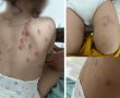 פרסום ראשון: חשד להתעללות בגן בעיר; פעוט אושפז עם חבלות קשות